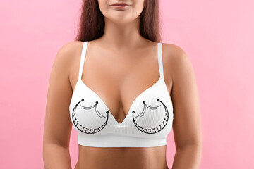 Breast surgery. Woman with markings on bra against pink background, closeup