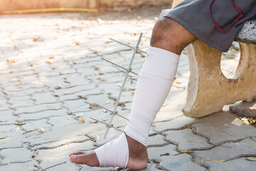Man with crutches at park, Broken leg.