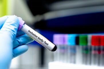 Fototapeta premium Blood sampling tube for inclusion body analysis.
