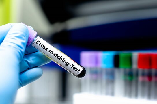Blood sampling tube for cross matching analysis.