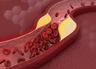 Clogged arteries on scientific background. 3d illustration.