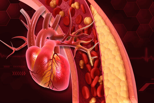 Blocked arteries with human heart diagram. 3d illustration.
