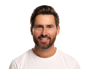 Obraz premium Man with markings for cosmetic surgery on his face against white background