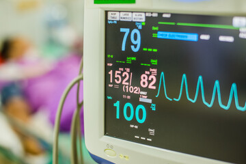 Modern vital sign monitor on patient background at ward in the hospital.