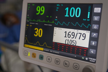 Modern vital sign monitor on patient background at ward in the hospital.