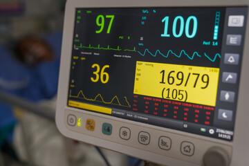 Modern vital sign monitor on patient background at ward in the hospital.