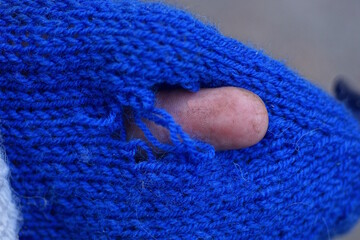one brown finger in a hole in torn blue woolen fabric of old clothes