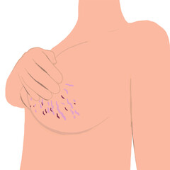 stretch marks on breasts vector illustration. Naked woman with stretch marks