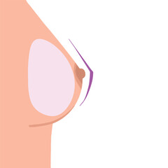 teardrop shape breast implant. Round silicone implant vector illustration. Plastic surgery