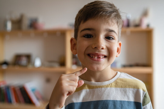 boy with Deciduous primary milk teeth lost tooth fallen out dropped