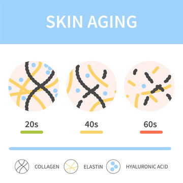 Skin aging process showing reduction of collagen, elastin and hyaluronic acid cells with time. Skin firmness and elastisity changes. Beauty and wellness concept. Medical vector illustration.