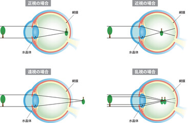 正視　近視　遠視　乱視　目の構造　文字あり