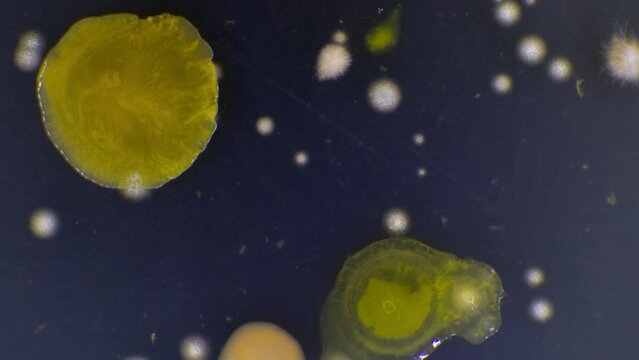 experiment on growing GMO bacteria capable of decomposing plastic in the world's oceans