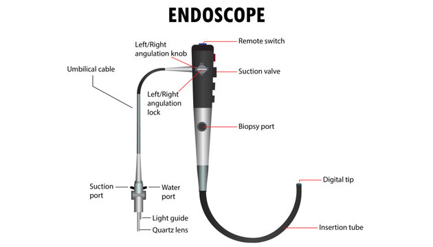 Diagram of the endoscope, parts of the endoscope