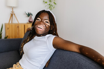Joyful young teenage girl with vitiligo looking away while relaxing on sofa at home. Diversity and...