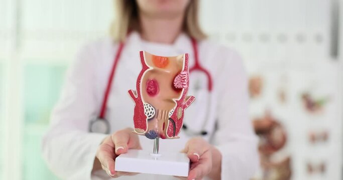 Doctor proctologist holding in hands artificial model of human rectum closeup 4k movie. Diagnosis and treatment of hemorrhoids concept