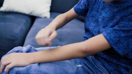 a child scratches his skin because of bedbug bites