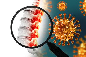 Spine cancer or spinal tumor disease. medical concept as skeletal vertebra with a magnifying glass. 3d illustration