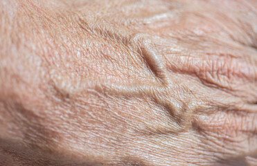 close up of human skin and veins