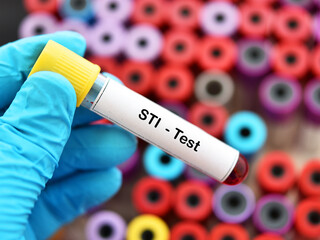 Blood sample for sexually transmitted infection (STI) test - obrazy, fototapety, plakaty