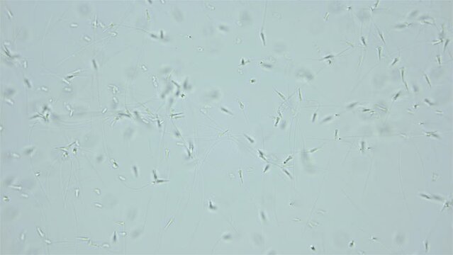 Sperm (spermotozoa) of sea snail Testudinalia testudinalis under microscope, family Lottiidae. Common name is common tortoise limpet. White sea