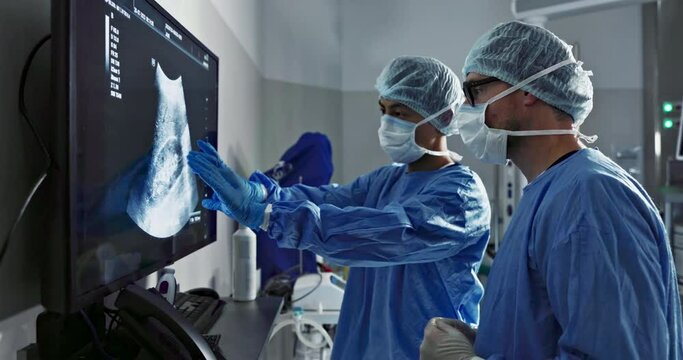 Surgery, scan and a team of doctors in the hospital for an operation or procedure to remove a tumor. Healthcare, medical teamwork and a surgeon looking at a screen with a medicine professional