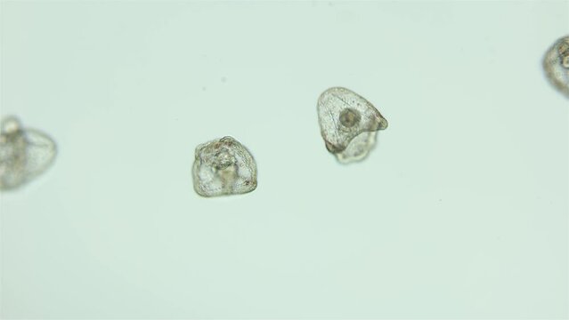 Larvae sea urchin Strongylocentrotus pallidus under microscope, phylum Echinodermata. Early stage of pluteus. White sea