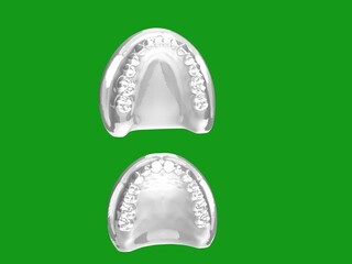 3D Illustration - Maxilla and Mandible - Dental - Dentist © Martina