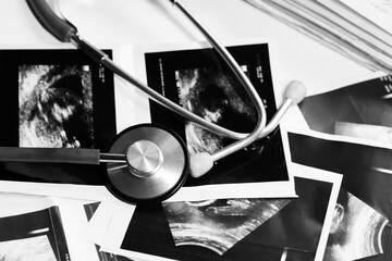 Stethoscope on medical imaging, health concerns