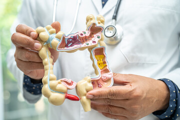 Intestine, appendix and digestive system, doctor holding anatomy model for study diagnosis and treatment in hospital. - obrazy, fototapety, plakaty