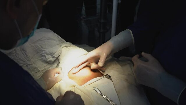 Dr teaching his students before the surgery