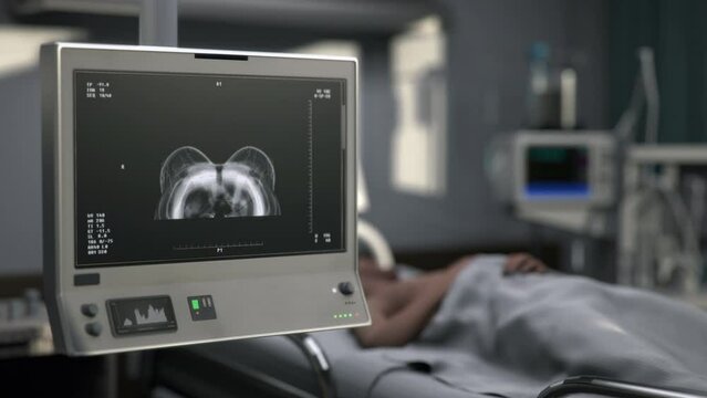 Medical X-ray screening of the sick patients breast at the hospital ward. X-ray screening test diagnosing potential diseases in the breast. X-ray screening analyses the breast condition.
