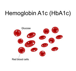 The picture represents a diagram of Hemoglobin A1c (HbA1c) that shows hemoglobin of red blood cell are bound with Glucose.