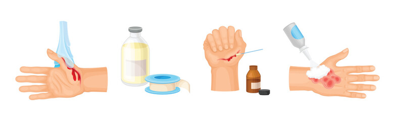 Hands with Injured Skin and Wound First Aid Vector Set