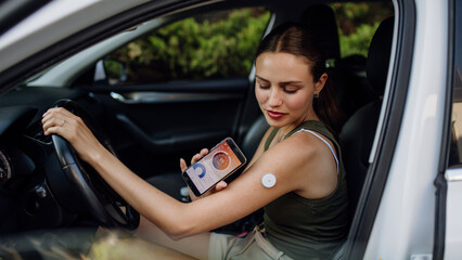 Woman with diabetes checking her blood glucose level before driving car. Diabetic woman connecting CGM to smartphone to monitor her blood sugar levels in real time.
