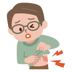 帯状疱疹の症状イラスト