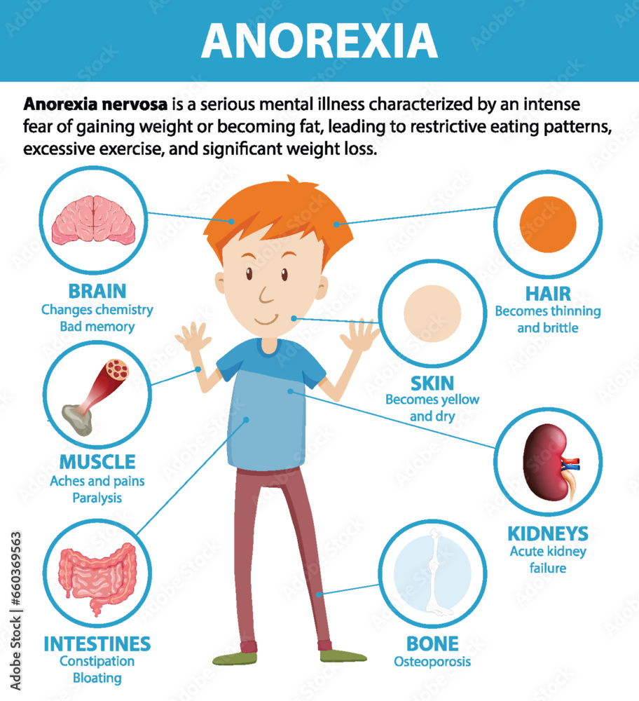 Poster Male Cartoon Anatomy with Anorexia Eating Disorder