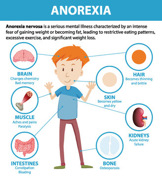 Male Cartoon Anatomy with Anorexia Eating Disorder