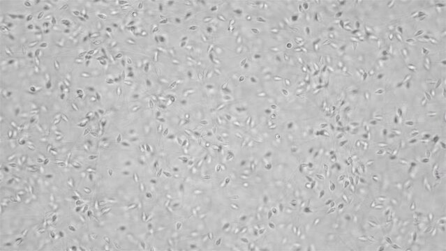 Sperm (spermotozoa) sea urchin Strongylocentrotus pallidus under microscope, phylum Echinodermata. White sea