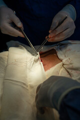 The surgical area is stitched up and another doctor looks after it