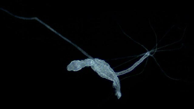 Larva of parasitic worm Progonus muelleri under a microscope, at Cercaria stage. Class Trematoda. White Sea
