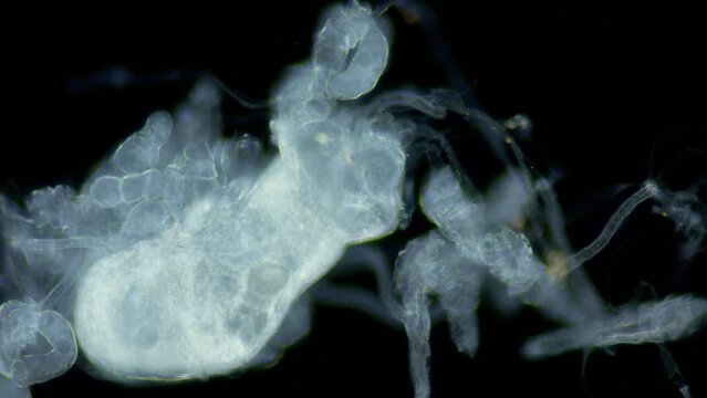 Larvae of parasitic worm Progonus muelleri under a microscope, at Cercaria stage. Class Trematoda. Got out of Sporocyst. White Sea