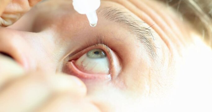 Man dripping liquid drops into dry eyes. Solving vision problem and caring for cornea of eye