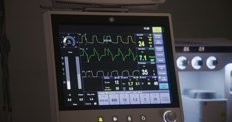Close up of electrocardiography monitor standing in operating room. Digital screen shows condition and hear rate of patient during surgical operation. Well-equipped surgery room in medical center. - obrazy, fototapety, plakaty