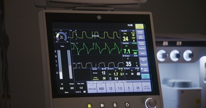 Close up of electrocardiography monitor standing in operating room. Digital screen shows condition and hear rate of patient during surgical operation. Well-equipped surgery room in medical center. - Powered by Adobe