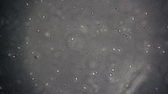 Slow zoom-in on microscopic human sperm cells swimming in seminal fluid.  A dead sperm cell with a clearly visible tail is seen.