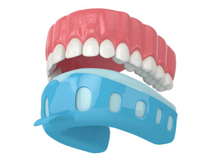 3d render of upper jaw with dental impression tray