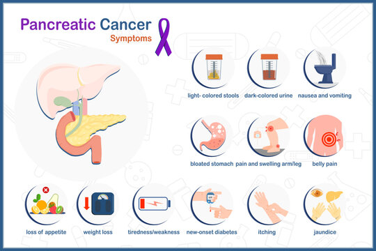 Vector medical illustration in pancreatic cancer concept. Symptoms of pancreatic cancer in flat style, isolated on white background and purple ribbon symbol of pancreatic cancer.