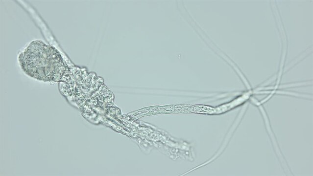 Larva of parasitic worm Progonus muelleri under a microscope, at Cercaria stage. Class Trematoda. White Sea