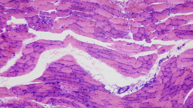 Bodybuilder muscles. Effect of Anabolics and growth hormones. Human skeletal muscle tissue under microscope, 400x times magnification. Longitudinal section. Smooth focusing and movement